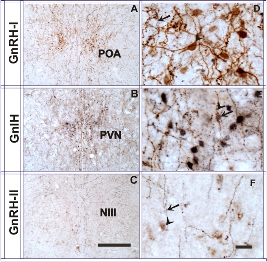Localization of GnIH, GnRH- I and –II peptide by double label Immunohistochemistry