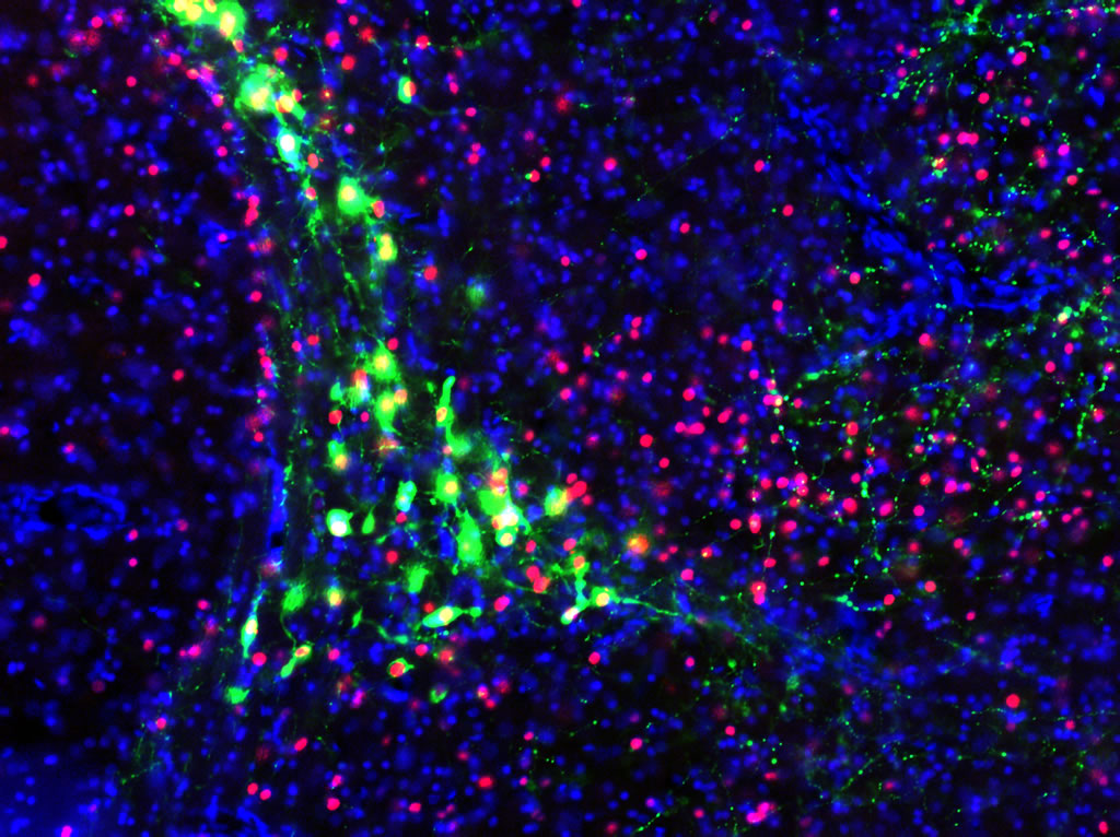 Neurons stained with DAPI (blue) and two antibodies (green and red) via immunofluorescence