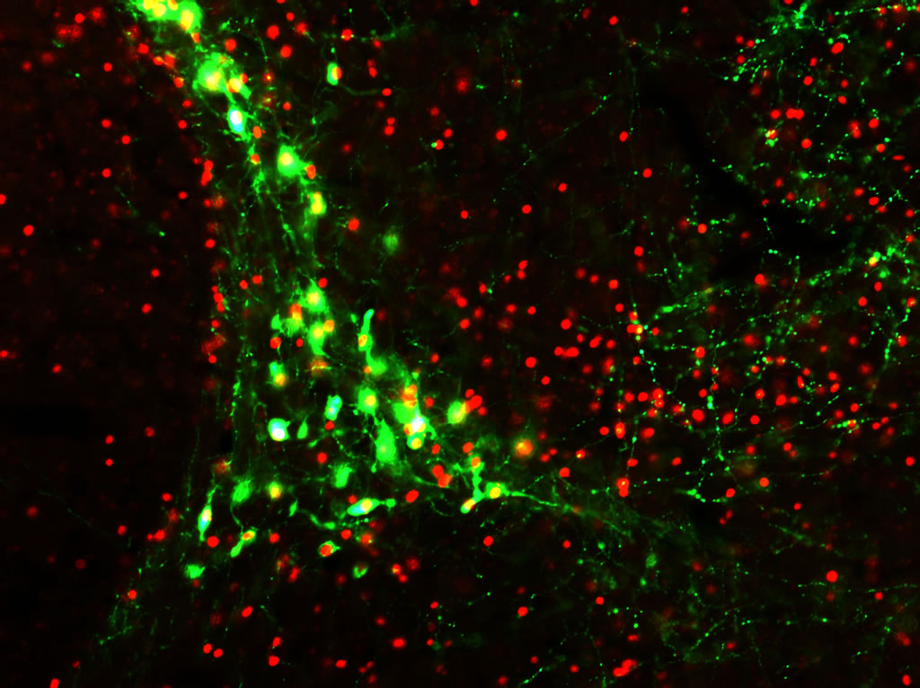 Double labelling of immunofluorescence for NPY and Cry 1 proteins