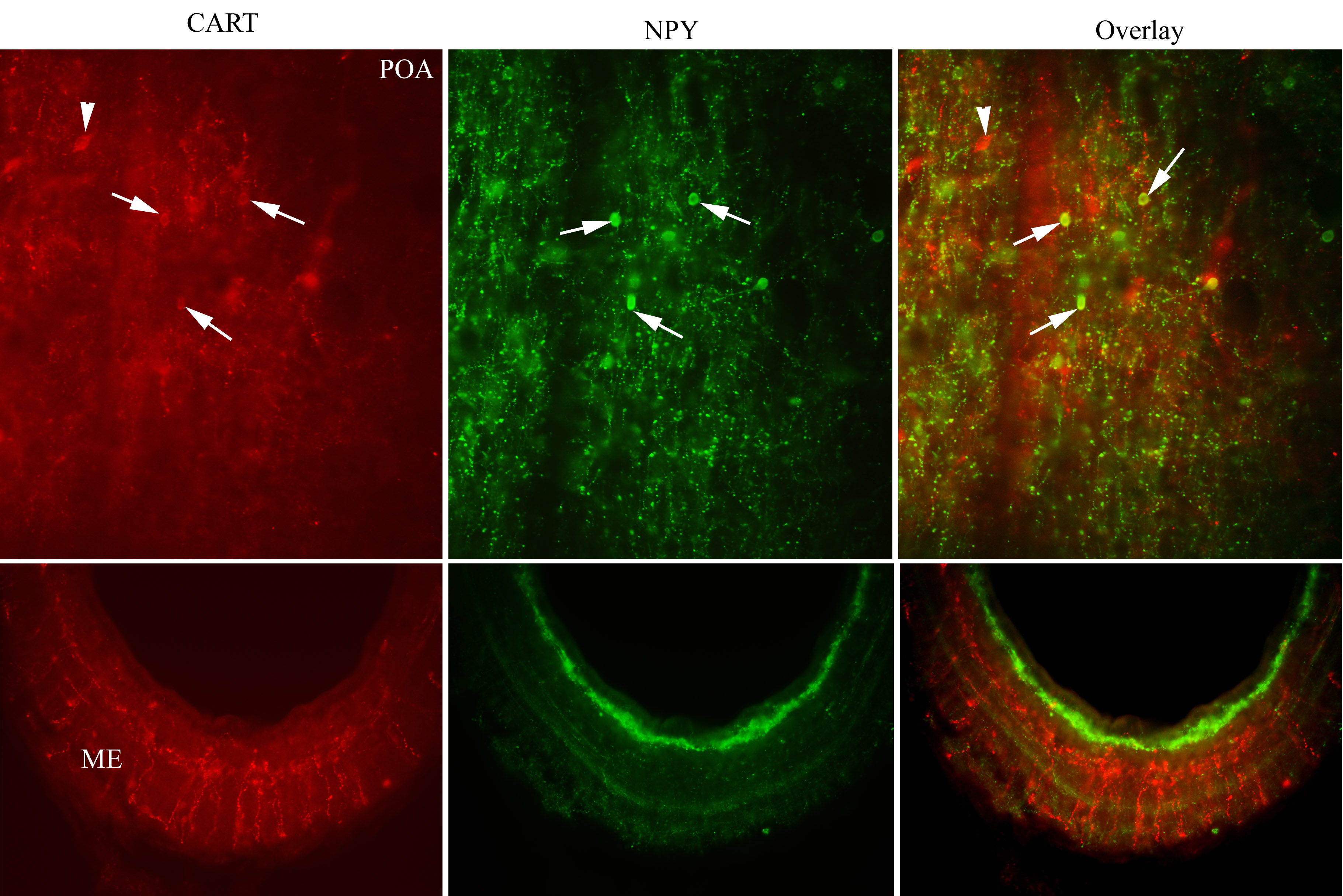 Fluorescent imaging of fluorescent proteins CART and NPY subcellular localization and their fusion expression