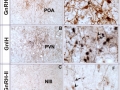 Localization of GnIH, GnRH- I and –II peptide by double label Immunohistochemistry