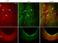 Fluorescent imaging of fluorescent proteins CART and NPY subcellular localization and their fusion expression
